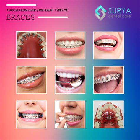 surya dental|surya dental site.